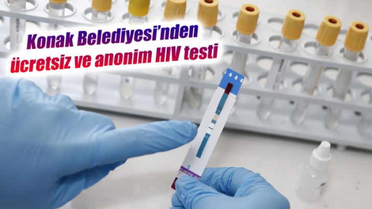 Konak Belediyesi’nden ücretsiz ve anonim HIV testi